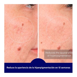 Augustinus Bader The Retinol Serum - Serum de retinol