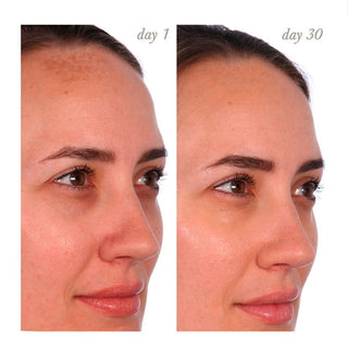 U Beauty Resurfacing Compound 30ml - Serum rejuvenecedor