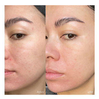 Westman Atelier Skin Activator Rollerball - Facial Serum