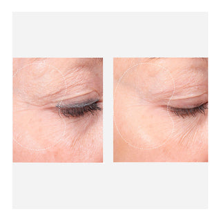 Dr. Barbara Sturm Super Anti-Aging Eye Serum