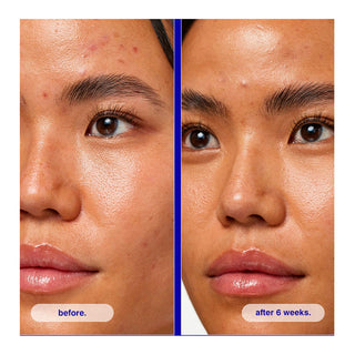 Malin + Goetz Retinol Correcting Serum - Serum de retinol