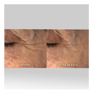 Dr. Barbara Sturm Super Anti-Aging Dual Serum - Serum antiedad