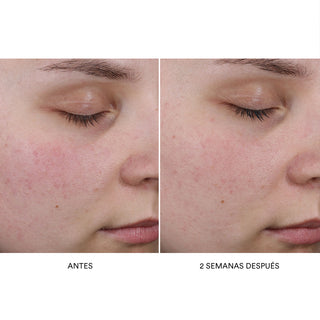 Westman Atelier Pore Refining Complex