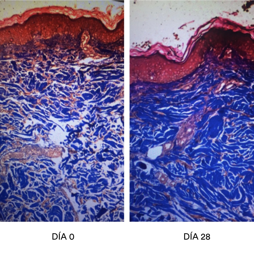 Biopsia antes y después aplicando Endor Essential Anti-Cellulite Cream